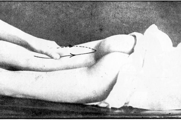 Lay Her Down Upon Her Back, Róisín White